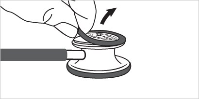 removing tunable diaphragm
